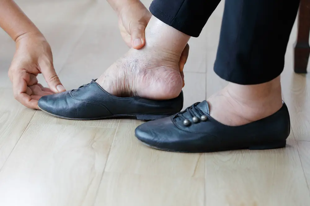 Shoes For Old Ladies With Swollen feet